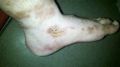 LV 2013-06-20 left ankle.jpg